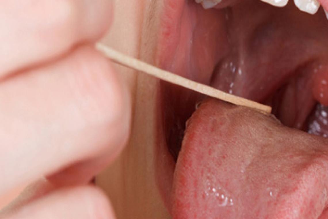 De qué se trata el estreptococo que ya causó 78 muertes en Argentina