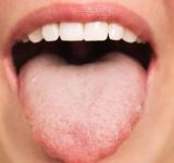 Cómo el patrón único de tu lengua puede influir en qué alimentos te gustan