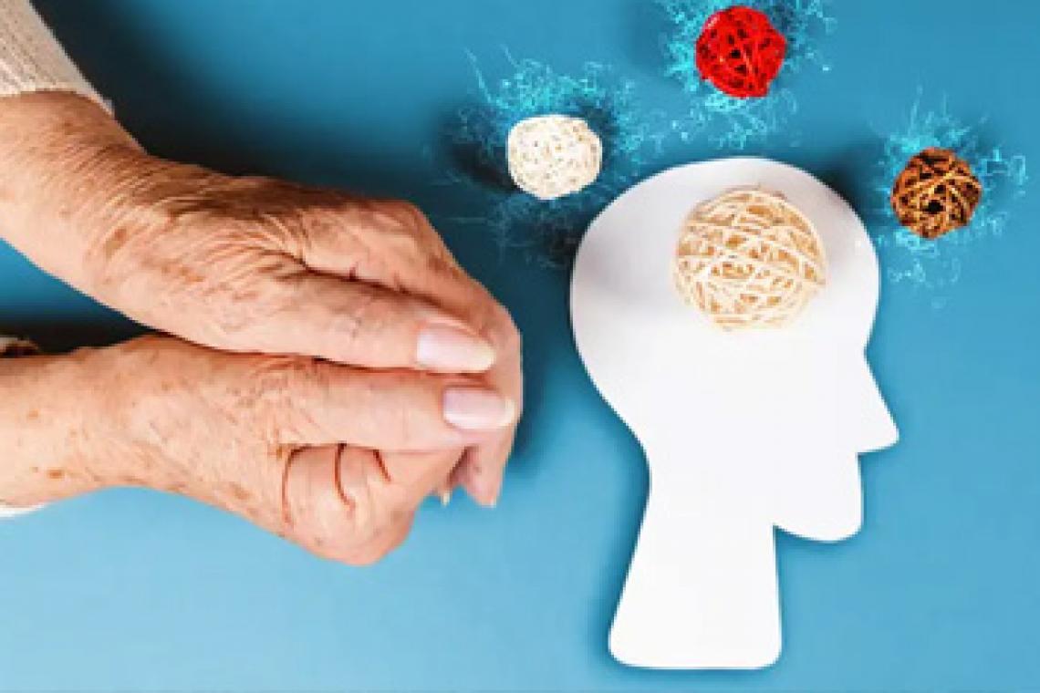 Examen de sangre diagnostica el alzhéimer con gran precisión.