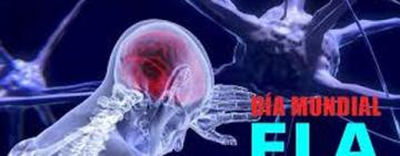 Día Mundial de la ELA: qué es, cuáles son sus síntomas y los nuevos tratamientos que dan esperanza