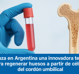 Avanza en Argentina una innovadora terapia para regenerar huesos a partir de células del cordón umbilical
