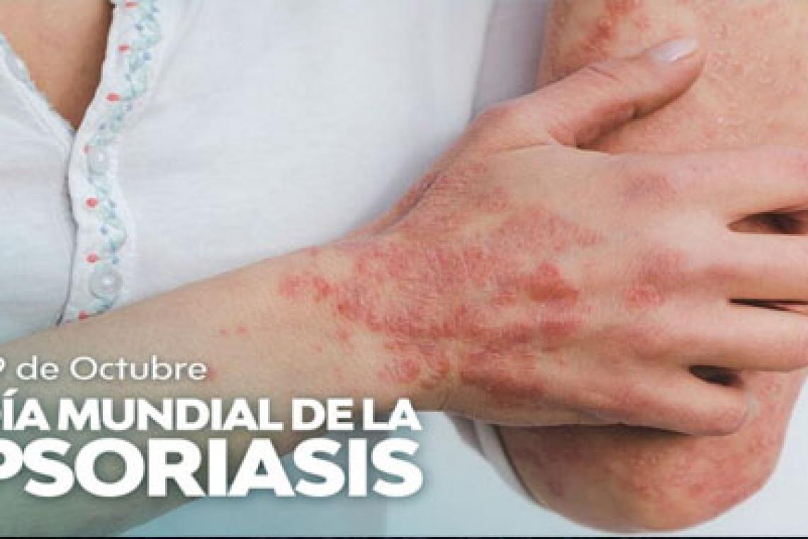Día Mundial de la Psoriasis