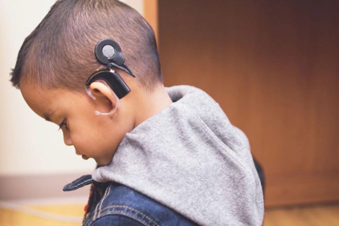 🎧 Día Mundial del Implante Coclear: qué es y por qué se conmemora hoy