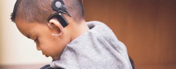🎧 Día Mundial del Implante Coclear: qué es y por qué se conmemora hoy