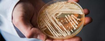 Brasil registra su primer posible caso de raro y potencialmente fatal hongo "Candida auris"