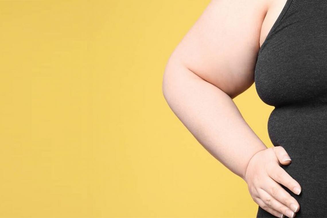 ¿Por qué las personas obesas corren más peligro si llegan a contagiarse?