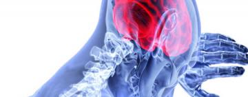 Día Mundial de la Esclerosis Múltiple: avanzamos, pero vamos por más