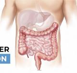 Salud avanza en la implementación de test para la prevención del cáncer de colon