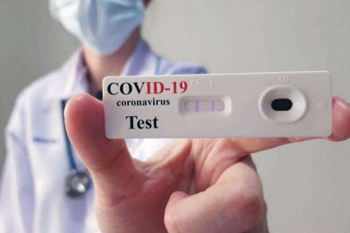Llegan los autotest de coronavirus a las farmacias para su venta al público