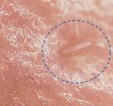 El problema de los diminutos ácaros que tienen sexo en nuestras caras