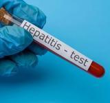 10 PREGUNTAS SOBRE LAS HEPATITIS VIRALES