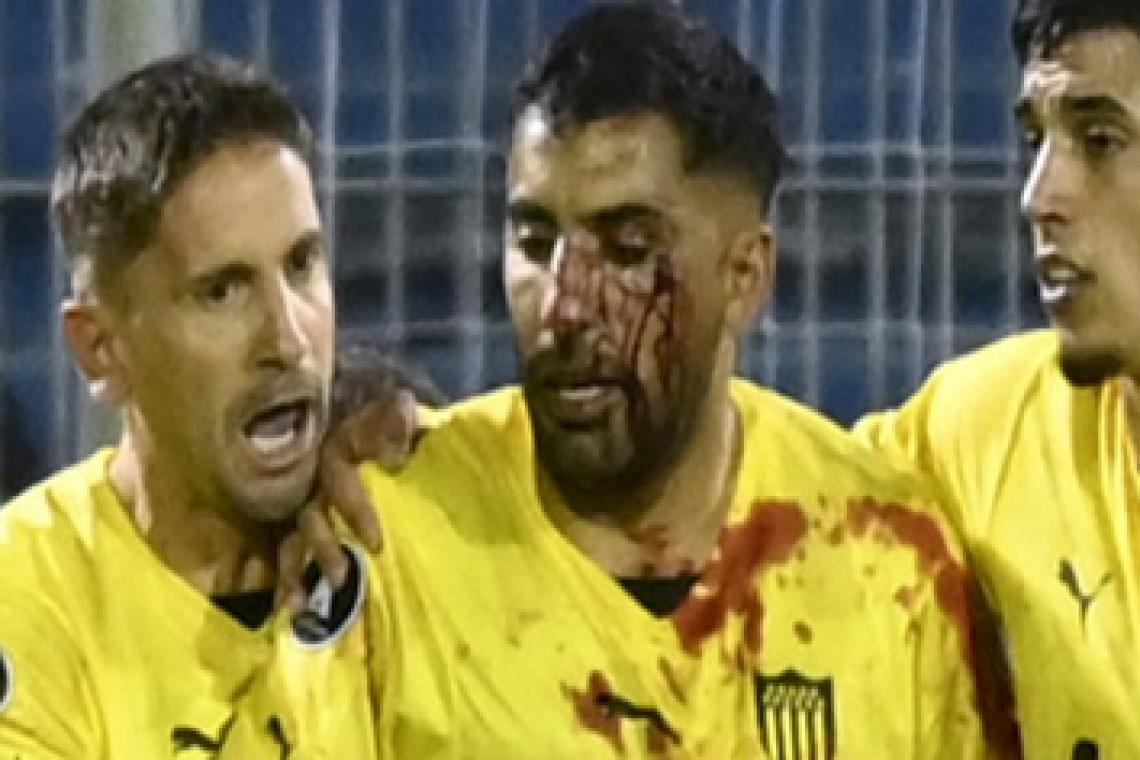 Un jugador de Peñarol recibió un corte tras ser agredido por un hincha de Rosario Central