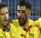 Un jugador de Peñarol recibió un corte tras ser agredido por un hincha de Rosario Central