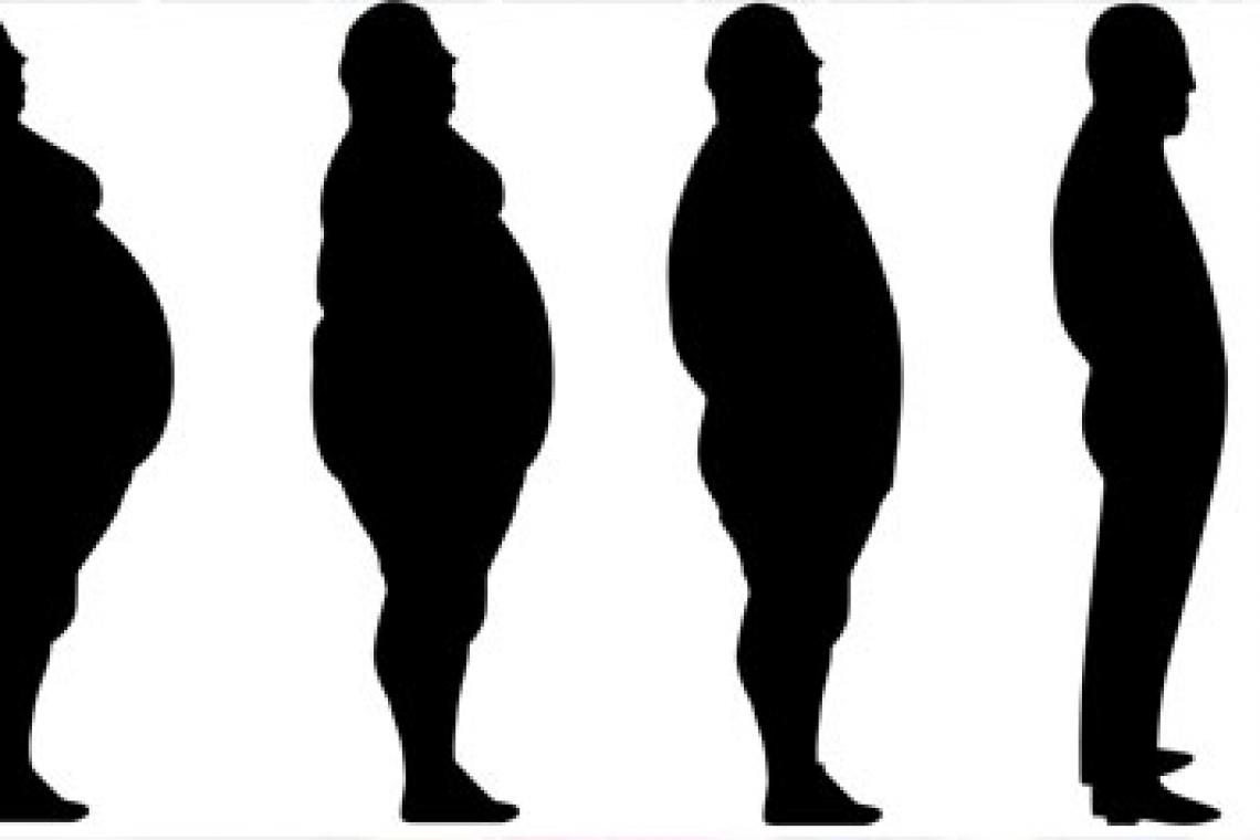 Las 10 medidas para mejorar el manejo de la obesidad que recomienda la Sociedad Argentina de Nutrición