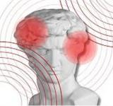 Migraña: la causa de discapacidad que más afecta a las mujeres jóvenes