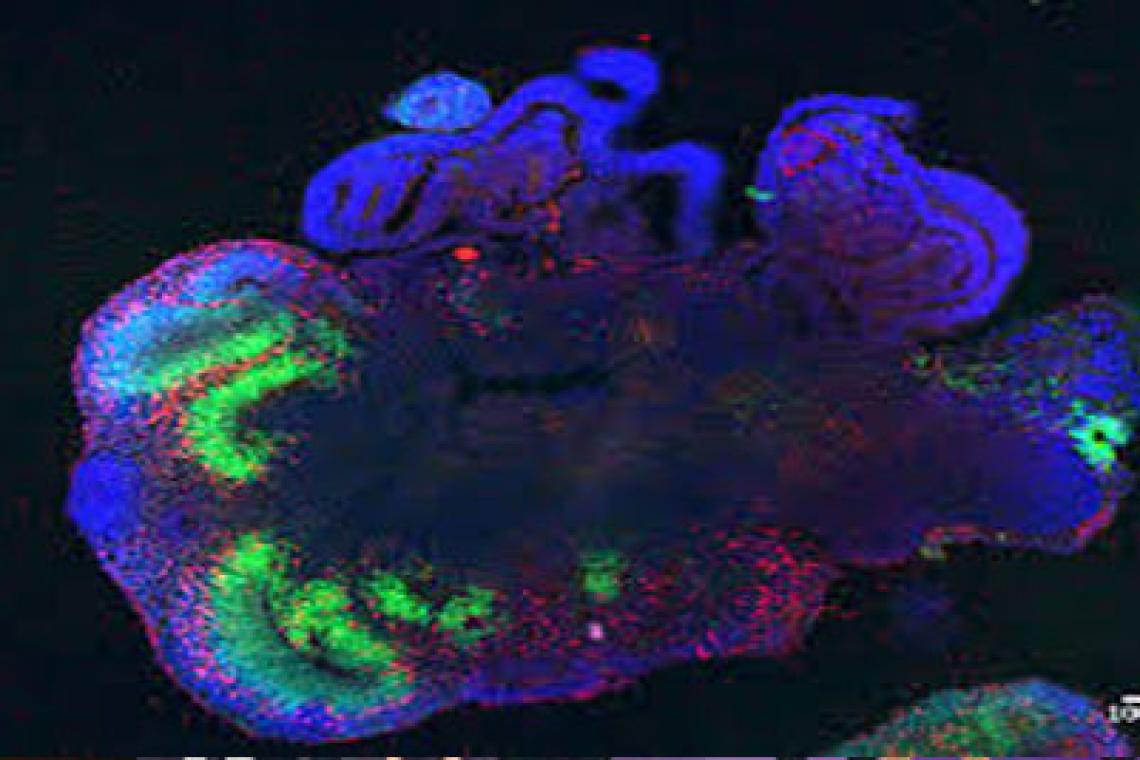 Científicos desarrollan “mini cerebros” humanos para alimentar computadoras