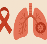 El cáncer de pulmón es el tercer tipo de cáncer más frecuente en Argentina: qué saber y cómo prevenirlo