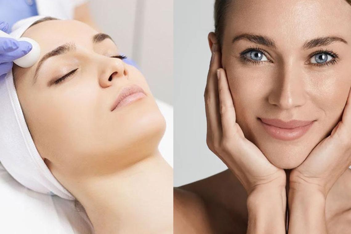 Párpados caídos y bolsas: cómo funciona la blefaroplastia con láser híbrido