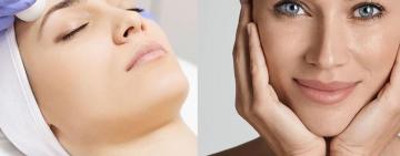 Párpados caídos y bolsas: cómo funciona la blefaroplastia con láser híbrido